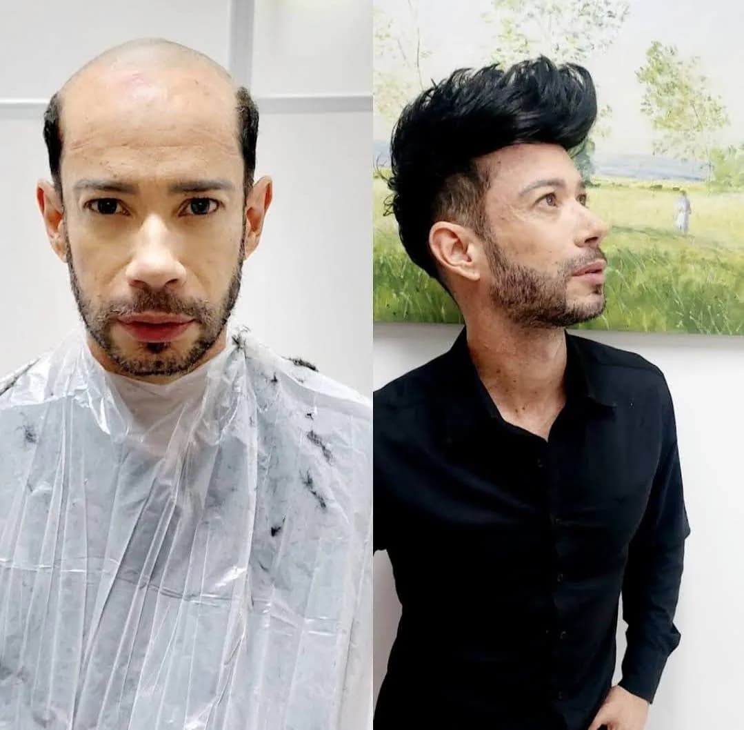cliente-antes-e-depois-topete-grande