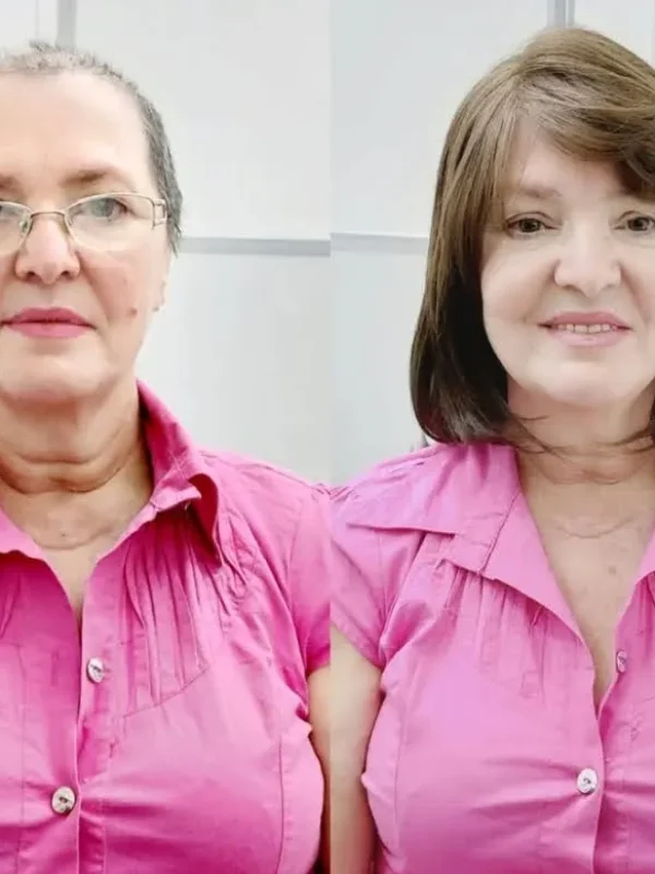 cliente-antes-e-depois-luci