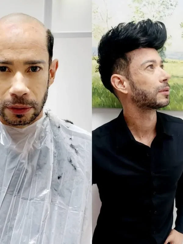 cliente-antes-e-depois-topete-grande